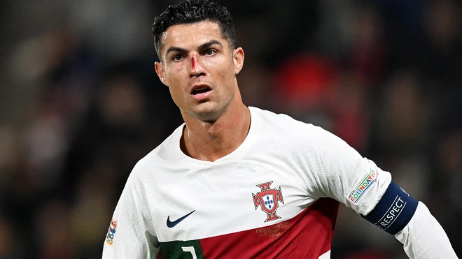 HLV Bồ Đào Nha giải thích lý do sử dụng Ronaldo - Bóng đá Anh