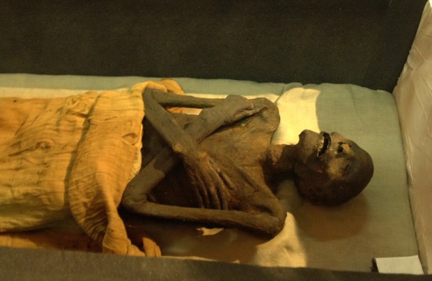 The 3,000-year-old mummy, of what is believed to be Ramesses...