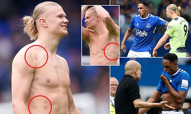 Manchester City: Shirtless Erling Haaland shows off battle scars from Yerry  Mina clashes | Daily Mail Online