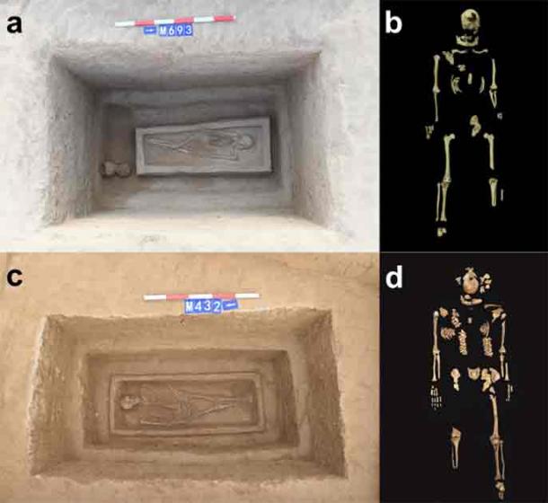 The two burials and the amputated skeletons found within them. (Wang, Q. et al/Archaeological & Anthropological Sciences)