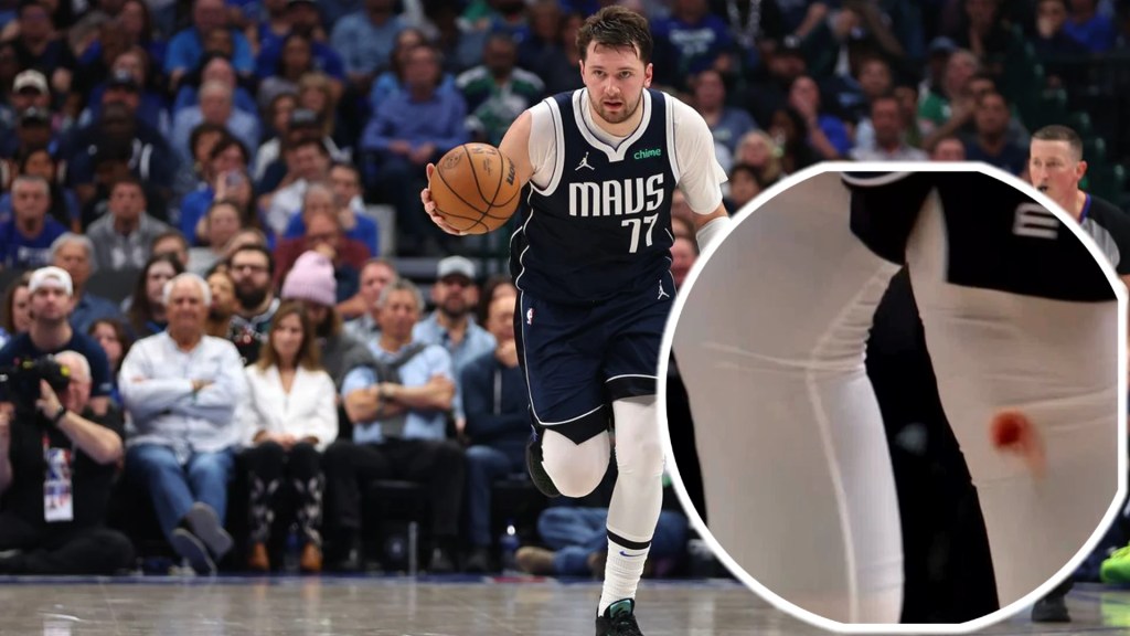 The Truth Behind Luka Doncic's Bloody Knees | Explained